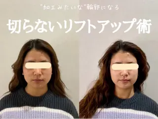 最速小顔・肌質管理 ❣️エスポワールのエステ・リラクイメージ