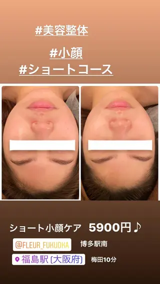 FLEUR大阪・整体 ・ハイフ・痩身・小顔のエステ・リラクイメージ