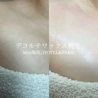 HOTEL&PARK .Moeワックス脱毛のエステ・リラクイメージ
