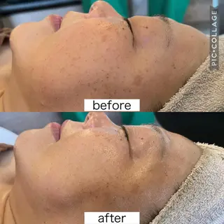 Beauty   Salon  Adiy所属・Adiy ikumiのエステ・リラクイメージ