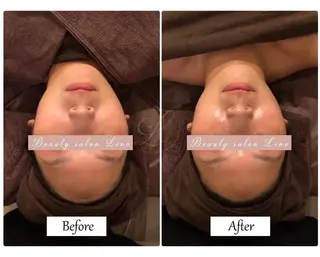 痩身×フェイシャル ブライダル|Linoのエステ・リラクイメージ