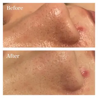 B&H所属・頭痛•肩こり専門/ 眉サロンB&H心斎橋のエステ・リラクイメージ