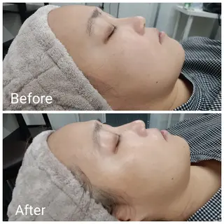 肌質改善Beauty salon Renのエステ・リラクイメージ