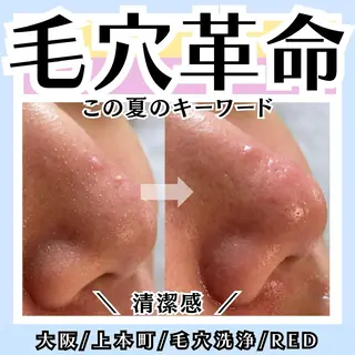 毛穴レス ハーブ＆ ワックス脱毛×光脱毛のエステ・リラクイメージ