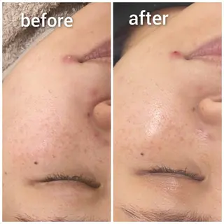 beauty salon by BMbm所属・名倉 彩乃のエステ・リラクイメージ