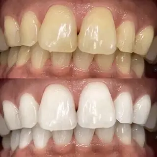 歯科提携セルフダック 宇都宮駒生店のエステ・リラクイメージ