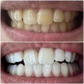 【Diar】オーナー アキヨシケンタのヘアスタイル