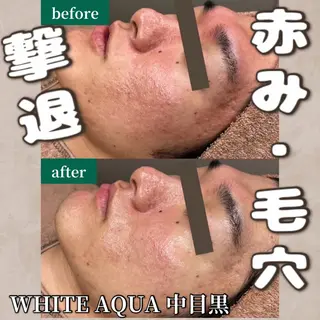 中目黒ハーブピーリン グ🌿ララピールのエステ・リラクイメージ