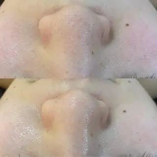 BELCIA福岡店　récolte de BELCIA（レコルトデベルシア）所属・BELCIA福岡店 レコルトデベルシアのエステ・リラクイメージ