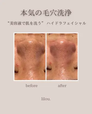 吉田 lilou.のエステ・リラクイメージ