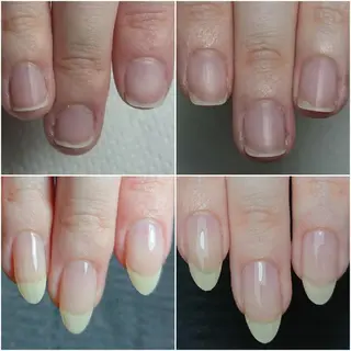 ネイル Jeliss~美爪育成ネイル＆頭蓋骨小顔矯正サロン~所属・美顔(小顔)矯正& 美爪育成Jelissのエステ・リラクイメージ