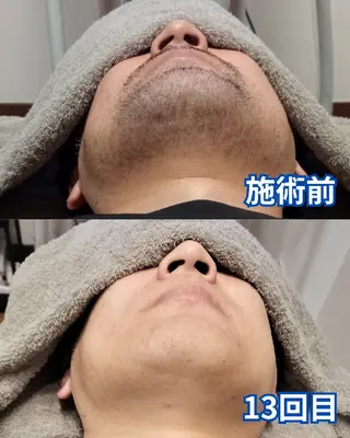 メンズ メンズ脱毛専門店Oceans所属・メンズ眉毛・脱毛専門 Oceansの眉毛・アイブロウイメージ