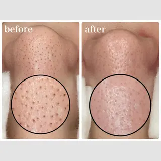 マツエク・マツパ 韓国肌管理 【毛穴専科】のエステ・リラクイメージ