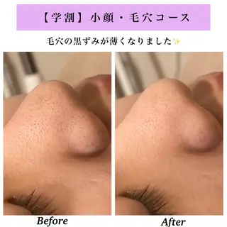 Bellesthe (ベルエステ)のエステ・リラクイメージ