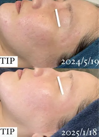 Ellebeauty relaxationのエステ・リラクイメージ