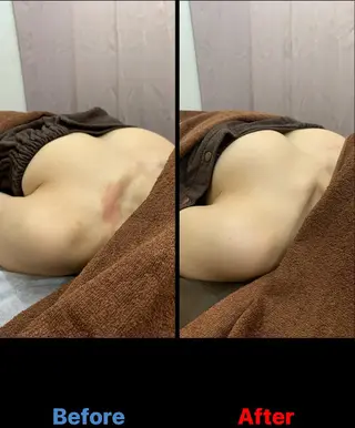 毛穴改善/脱毛 ネイル 川上久仁子のエステ・リラクイメージ