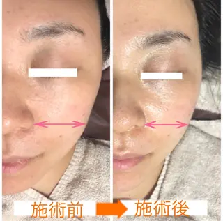 小顔・毛穴・たるみ ネイル　似内真樹のエステ・リラクイメージ