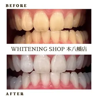 メンズ ホワイトニング ショップ本八幡店のエステ・リラクイメージ