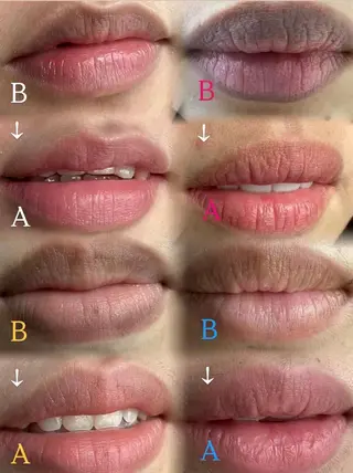 東洋美療　よつば所属・東洋美療 よつばのエステ・リラクイメージ