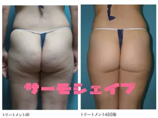 ﾄｰﾀﾙｽｷﾝｹｱ美容Room所属・トータルスキンケア 美容Roomのエステ・リラクイメージ