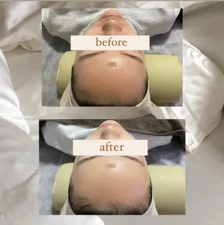 crescent所属・【韓国肌管理・脱毛】 クレセントのエステ・リラクイメージ