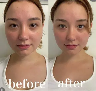 美容鍼灸サロン mahoroba院長のエステ・リラクイメージ