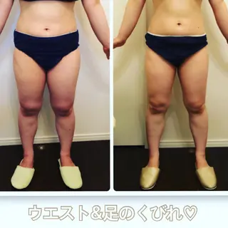 FLEUR大阪・美容 整体・痩身・小顔のエステ・リラクイメージ