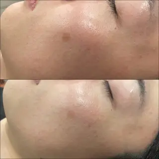 LiZA エステティックサロンのエステ・リラクイメージ