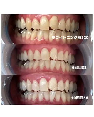 Whitening Beauty 行橋店所属・Whitening Beauty 行橋店のその他イメージ