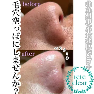 Soin＋ みきのエステ・リラクイメージ