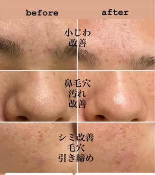 total beauty salon Raffoler所属・Raffoler りさのエステ・リラクイメージ