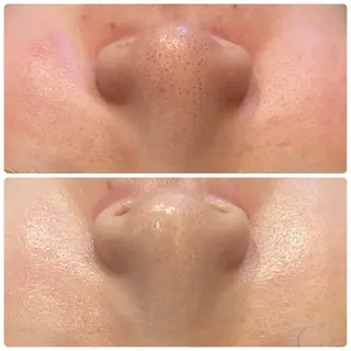 yellow.所属・yellow💛【 脱毛&フェイシャル】のエステ・リラクイメージ