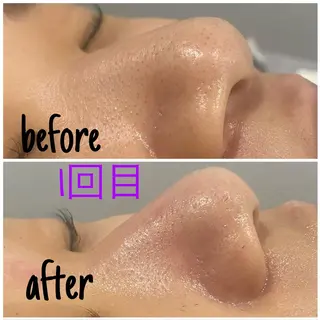 アルカンジュ~archange~所属・痩身/毛穴洗浄/脱毛 アルカンジュのエステ・リラクイメージ