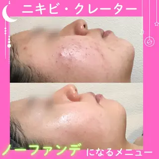 痩身&美肌サロン 堀米✨のエステ・リラクイメージ