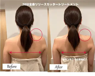 痩身×フェイシャル ブライダル|Linoのエステ・リラクイメージ