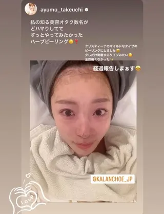 肌質改善 KALANCHOEのエステ・リラクイメージ