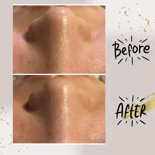 ピーリング専門店 Belluteのエステ・リラクイメージ