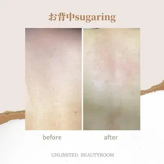 恵比寿💎 UNLIMITEDのエステ・リラクイメージ