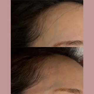 肌育×小顔×毛穴洗浄 ただののエステ・リラクイメージ