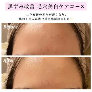 Bellesthe (ベルエステ)のエステ・リラクイメージ