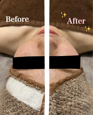 脱毛サロン fam.豊澤柚良のエステ・リラクイメージ