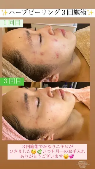 Salon de Lino 御器所のエステ・リラクイメージ