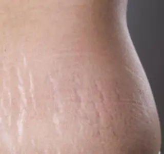 小顔美肌&痩身サロン My Timeのエステ・リラクイメージ