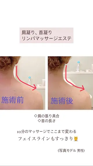 肩首こり×痩身×浄化 🌿リンパエステのエステ・リラクイメージ