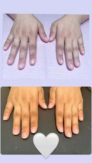 メンズ ネイル 爪ケア/深爪 自爪育成 🐰えむのネイルデザイン