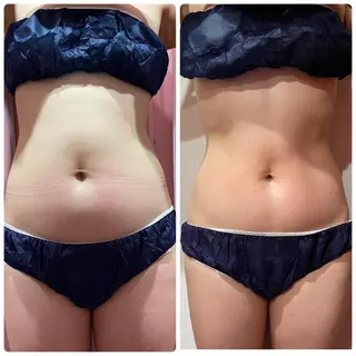 ニキビ、痩身、脱毛、 サクラチャンスパのエステ・リラクイメージ