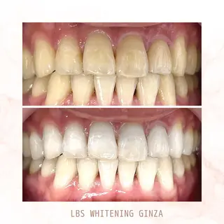 メンズ LBSホワイトニング 銀座店💎店長浦和のその他イメージ