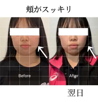 小顔と ヘッドスパのお店のエステ・リラクイメージ