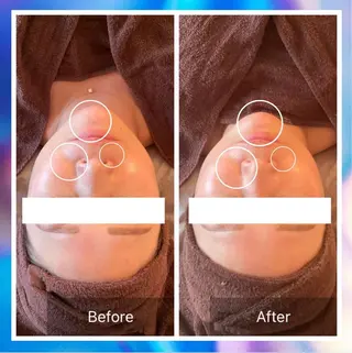 Lumiere despoir所属・Lumiere despoirのエステ・リラクイメージ