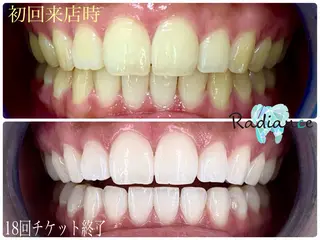 札幌ホワイトニング ラディアンス札幌駅店のその他イメージ